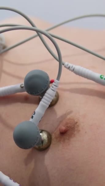 病院の女性医師の心臓検査では 男性の患者が最新のテクノロジーマシンを使用して胸に特別な吸引カップを置く 患者にエッグを与えることで — ストック動画