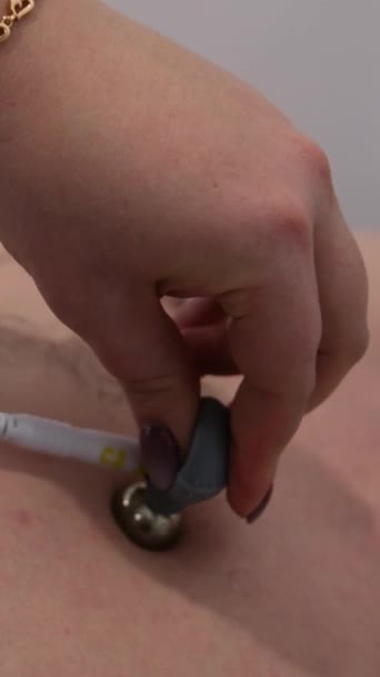 Kardiogram Szpitalu Lekarz Bada Pacjenta Mężczyzna Kładzie Specjalne Przyssawki Klatce — Wideo stockowe
