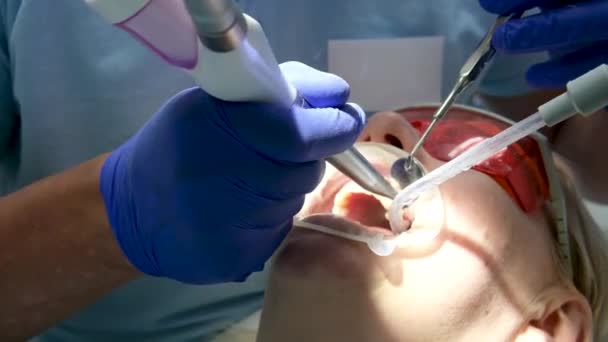 Accessoires Voor Tandheelkundige Behandeling Het Patiëntenbehandelingsproces Hoge Kwaliteit Beeldmateriaal — Stockvideo