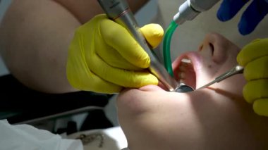 Lateks eldivenli dişçi lambaları değiştiriyor ve klinikte hasta dişlerini inceliyor. Yüksek kalite 4k görüntü