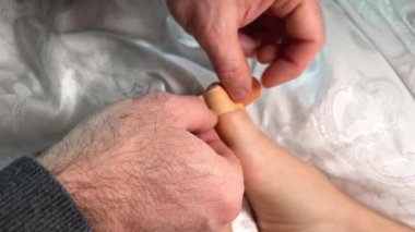 Su nasırı, ayak parmağı su toplamış, yapışkan bantla yapıştırılmış, çinko merhemle yayılmış, tedavi, sıkı ayakkabılar, rahatsızlık, acı, hastalık. Ayak pedikürü evde. Erkek elleri yakın plan