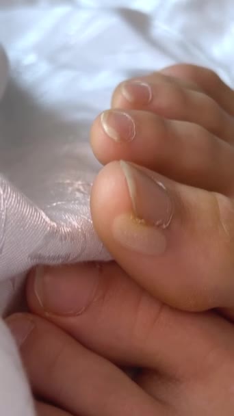 水愈伤组织 足趾水泡 用胶粘带密封 涂锌软膏 在家里修脚 男性手部特写 — 图库视频影像