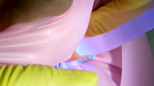 Stomatologia Dojrzewanie Lekarz Żółtych Rękawiczkach Wypełnia Ząb Młodej Dziewczyny Dla — Wideo stockowe