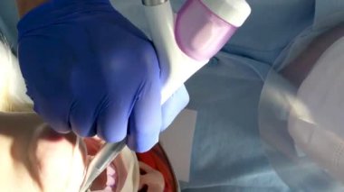 Bir diş kliniğinde diş temizliği, taş ve plaket çıkarmak, bir kadınla çalışan genç uzmanlar, salya püskürtücüsünü temizlemek, tükürük emmek, dişlere boya sürmek,