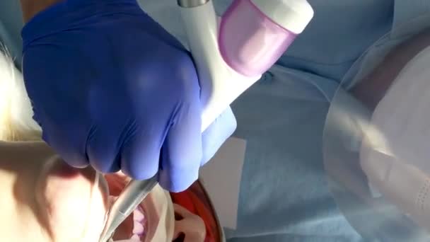 Επαγγελματικός Καθαρισμός Δοντιών Οδοντιατρική Κλινική Αφαίρεση Λίθων Και Πλάκας Νέοι — Αρχείο Βίντεο