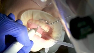 En son teknoloji temizliği ve diş beyazlatma hemşiresi ve doktor genç bir dişçinin dişlerini tedavi ediyor. Genç bir kızın maskeleri eldivenleri temizleme temizliği yapıyor. Klinikteki en son cihaz.