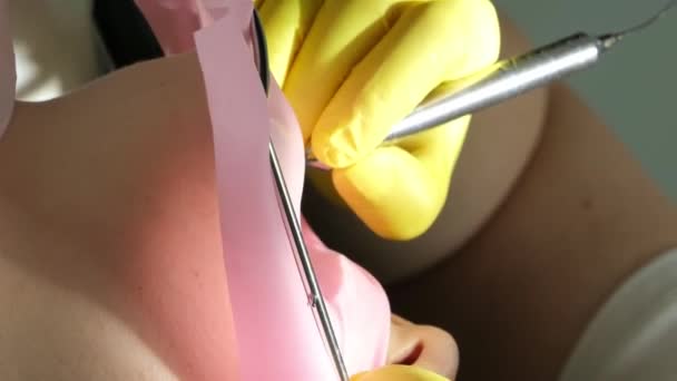 Dentistry Adolescence Doctor Yellow Gloves Fills Tooth Young Girl Woman — Stock Video