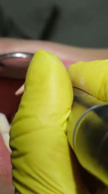 Genç kadın dişçi. Ortodontiste resepsiyon. Diş tellerinin değiştirilmesi. Cilalıyorum. Jel yapıştırma. Yüksek kalite 4k görüntü