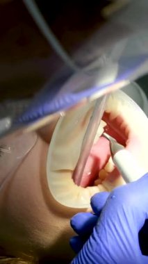 Blepharoplasty estetik ameliyatı. Gençleştirme, göz bölgesini modifiye etme. Yüksek kalite 4k görüntü