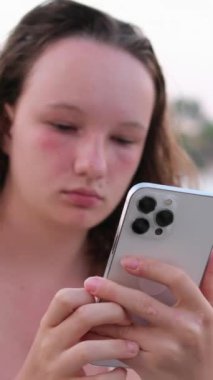 Esneyen bir kız, sipariş veren, arkadaşlarıyla iletişim kuran, sosyal ağları ve interneti kullanan. Yanık tenli genç bir kızın plaj duygularında dinleniyor. kırmızı yanaklar ıslak saçlar.