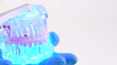 Dental Reconstruction of Jaw with Dental Scanner. Modern dental clinic laboratory. Hi-tech dental scanner with gypsum jaw model. Teeth Mould being analyzed.
