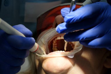 Doctor scans the patients teeth in the clinic. The dentist holds in his hand a manual 3D scanner for the jaw and mouth. Dental health. Creates teeth and gums on medical monitor.