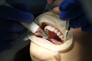 Dentists hands giving anesthetic injection to female patient during dental procedure in clinic. Doctor making anesthetic injection to woman in dentistry office. Dental treatment concept.