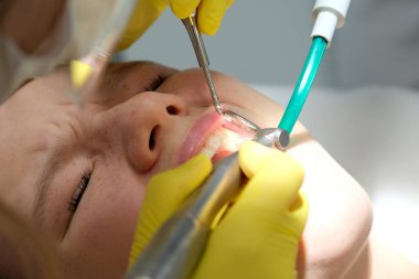 Dentists hands giving anesthetic injection to female patient during dental procedure in clinic. Doctor making anesthetic injection to woman in dentistry office. Dental treatment concept.