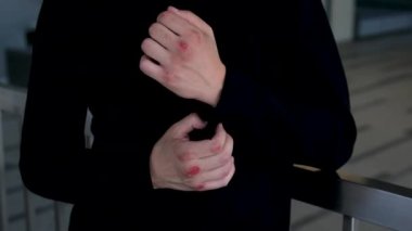 Eli kanayan bir boksör siyah bir gömlek giyer. Siyah saçlı ve mavi gözlü yakışıklı bir adam. Melez ırk uyruğu. Boks antrenörünü ya da bir boksörün ellerini saran menajeri kapatın.