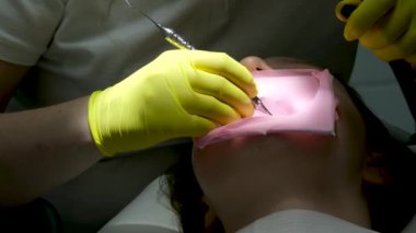 Dişçi dolgusu. Kadın dişçi, dişçi kliniğinde genç kız hastaların dişlerini muayene ediyor. Bir kaşif kullanarak dişleri sondajlayan doktor çürük tedavisi ve kontrol için