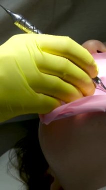 Dişçi dolgusu. Kadın dişçi, dişçi kliniğinde genç kız hastaların dişlerini muayene ediyor. Bir kaşif kullanarak dişleri sondajlayan doktor çürük tedavisi ve kontrol için