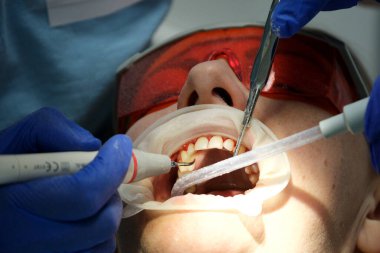 Diş tedavisi sırasında dişçi koltuğunda genç bir kadının yukarı bakıp gülümsediği yakın plan çekimler. Modern klinikte hastaların dişlerini muayene eden dişçi. Sağlıklı dişler ve ilaçlar