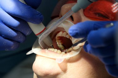 Bir kliniğin sandalyesinde yatan bir hastanın ağzını inceleyen dişçi ve asistan. Yüksek kalite fotoğraf