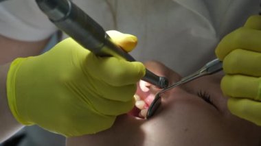 Doktor, hastalarda diş tedavisi için açık ağızlı aletlerle çalışıyor. Yüksek kalite 4k görüntü