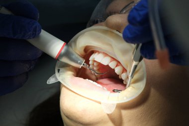 Diş asistanı, diş aletleri, diş kontrolü. Mavi önlüklü dişçi kırmızı önlüklü diş hekiminin yardımıyla hastaların dişlerini muayene ediyor. Yüksek kalite 4k görüntü