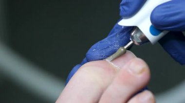 Ayak tedavisi prosedürü. Tırnak törpüsü matkabıyla donanım tıbbi pedikür. Pedikür tedavisi gören hasta. Özel bir cihazla kaplıcada ayak soyma tedavisi. Podoloji Kliniği.