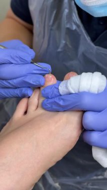 Klinikteki şok dalgası terapisine hazırlanıyorum. Yüksek kalite 4k görüntü