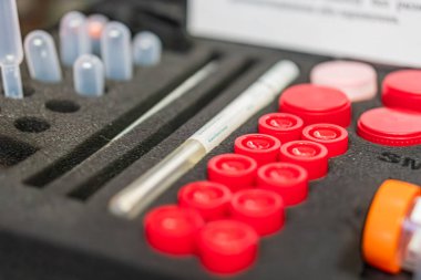 Tıbbi teçhizatlı siyah bir çantanın yakından görüntüsü kırmızı lastik tıkaçlar, temiz plastik boru, kimyasal analiz için test tüpleri, organize depolama