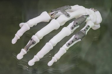 Mekanik parmaklara yerleştirilmiş 3 boyutlu titanyum protezlerin yakın plan resmi, hareket için poz verilmiş, parmak uçlarında dairesel sensörler, yapay deri tonu, nötr arkaplan, sergilenen teknolyo