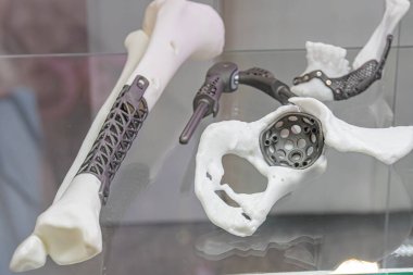 Titanyum protezler 3 boyutlu, bir müze sergisinde iskelet modelleri ve tıbbi aletlerle sergileniyor. Ana iskelet, iç organlar, kalp, akciğerler, sindirim sistemi, çıkarılmış.