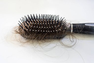 Ekstrem saç kaybı, beyaz arka planda fırça. .