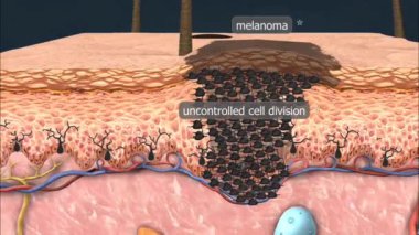 Ultraviyole radyasyon melanositlere zarar verdiğinde melanin, güneş kremi ve güneş ışığını sınırlayan koruyucu maddeler kullanılır..