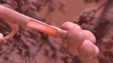 Kronik obstrüktif akciğer hastalığı (Kronik obstrüktif pulmoner hastalık) ve kronik bronşit, uzun süreli iltihaplanma nedeniyle solunum güçlüğü, öksürük ve mukus üretimine neden olan akciğer durumlarıdır..