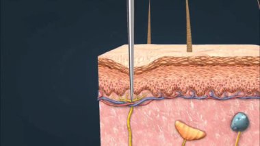 Ağrı saptama ya da nociception, deride, kaslarda ve organlarda nocicreseptörler adı verilen özel reseptörler içerir.. 