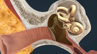 Otitis medyası veya orta kulak enfeksiyonu, bakteri veya virüslerin neden olduğu orta kulağın iltihaplanmasıdır. Belirtiler arasında kulak ağrısı, sıvı birikmesi, ateş ve işitme kaybı yer alıyor..