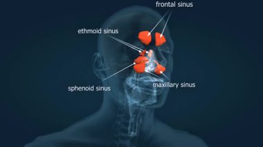 Paranasal sinüslerin anatomisinin 3 boyutlu animasyonu, yerlerini ve burun boşluğuna olan bağlantılarını gösteriyor..