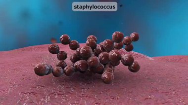 3D animation shows Staphylococcus cocci clustering like grapes, colonizing skin and causing infections.