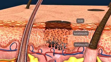 3D animation of human skin mole formation, showing keratinocytes and melanocytes interaction.