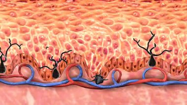 3D animation of skin cancer, illustrating melanoma formation and abnormal cell growth.