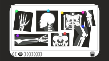 İnsan vücudunun çeşitli röntgen görüntülerinin vektör çizimleri. Çizgi film X-ray görüntüleri tahtaya iliştirilmiş: kolların ve bacakların kemikleri, kafatası, iskeletin göğüs hücresi, pelvis kemikleri..