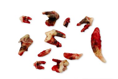 Çekildikten sonra enfekte olmuş köpek dişleri. Diş çektirmek. Diş kalkülüsü ve kırık diş taşı olan köpek dişi. Pulp enfeksiyonu.