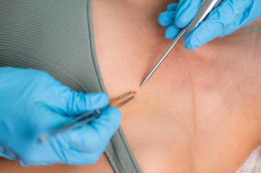 Cilt lezyonlarını inceleyen dermatolog, doğru teşhis ve kişisel bakım için hayati kavrayışlar ortaya çıkardı.. 