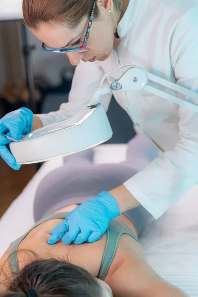 Dermatologische Untersuchung Eines Hautmaulwurfs Unverzichtbar Für Diagnose Und Behandlung — Stockfoto