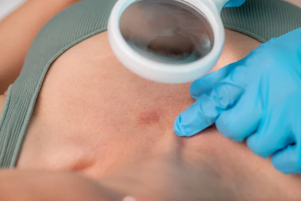 stock image Dermatologist examining skin lesions revealing crucial insights for accurate diagnosis and personalized care. 