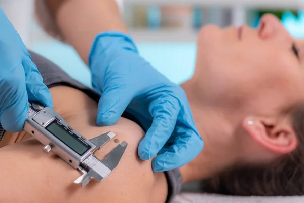 Dermatology doctor measures moles using a digital caliper. Precise measurement for effective monitoring and early detection of potential concerns.