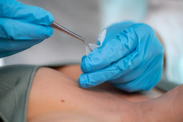 병변을 조사하는 피부과 전문가는 개인적 치료에 통찰을 — 스톡 사진