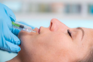 Hyaluron dolgu tedavisiyle, dermatolog dikkatle kadın yüzündeki ince çizgilere hyaluronik asit enjekte ediyor.