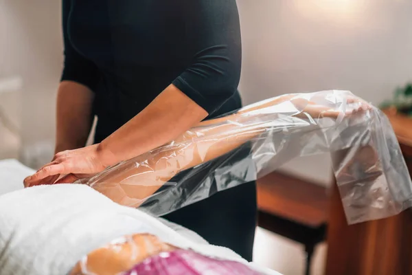 Antycellulitowa Terapia Próżniowa Ręce Nogi Kobieta Leżąca Stole Masażu Centrum — Zdjęcie stockowe
