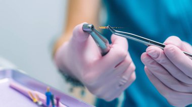 Bir Endodontist Barbed Broach, Diş Kliniğinde Kanal tedavisi.