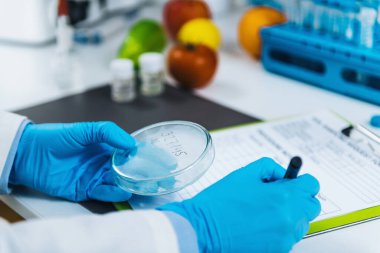 Mikrobiyoloji Laboratuvarında Gıda Kalite Değerlendirmesi, standart işletim prosedürünü izleyen mikrobiyolog doldurma formları 